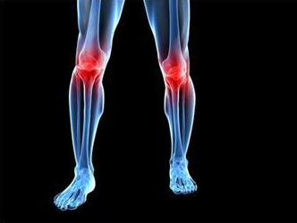 Patología degenerativa de rodilla