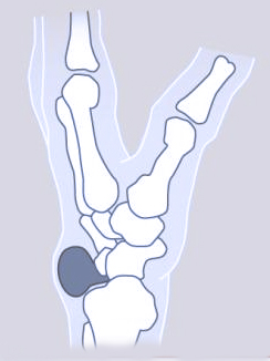 Fig 5